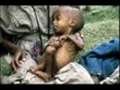 #Graphic# African Starvation 