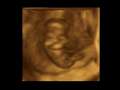 Pro-Life Ultrasound Video 