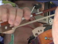 Musician Plays Violin as Surgeons Operate on His Brain 
