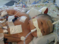 A touching story about the fight for life this newborn is going through. 