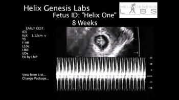 Human Clone Pregnancy Ultrasound Video - is this real? 