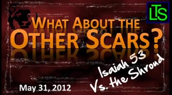 This lesson pulls from Scriptural passages that describe what Jesus went through during His scourging. The Sunday School picture that we have of a man on the cross with holes in His hands and feet, along with a side wound from the Roman spear, is simply not accurate and one must understand what He went through for our sins to fully appreciate our need to accept Him as Savior. This lesson will paint vivid images in your mind of what His body looked like as He accomplished your salvation!