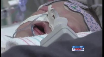 Miracle Baby Survives Being Born With Heart OUTSIDE Her Body 