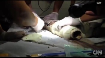 Baby Flushed Down Sewer Miraculously Survives - A Miracle of God! (Viewer Discretion Advised) 