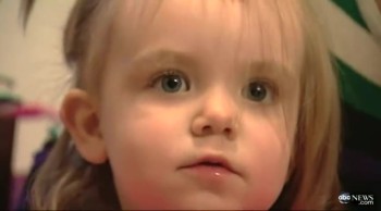 Toddler Miraculously Survives a Pencil Piercing Through Her Eye and Brain 