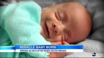 39 Days After Her Water Broke, This Mother Finally Gave Birth. Her Sacrifice for Her Miracle Baby is Amazing