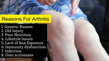 Best Ways to Get Relief from Arthritis Pain Naturally 