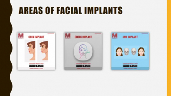 Facial Implants - Meddco 