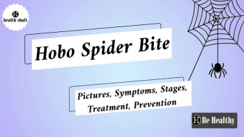 Facts about Hobo Spider Bite: Pictures, Symptoms, Stages, Treatment, Prevention 