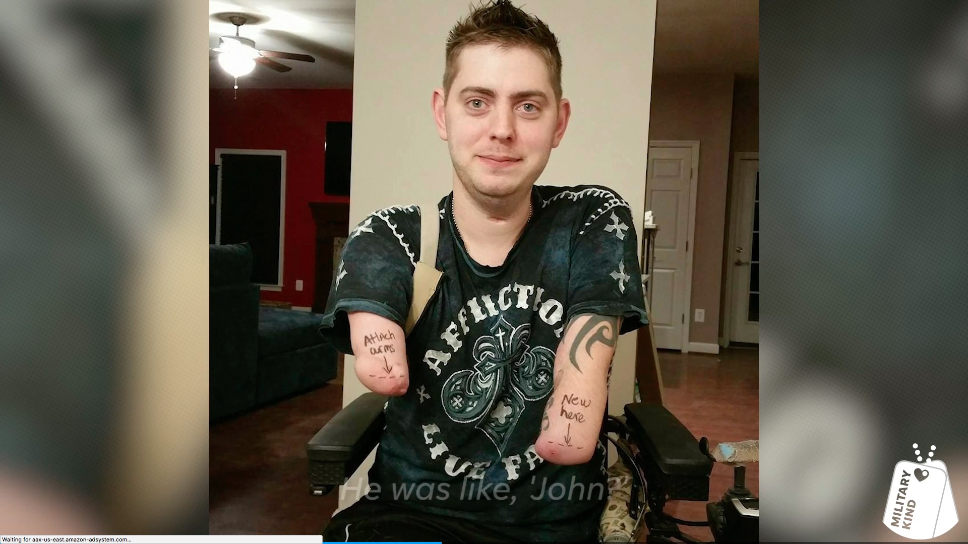 Marine Sgt. John Peck - double arm transplant