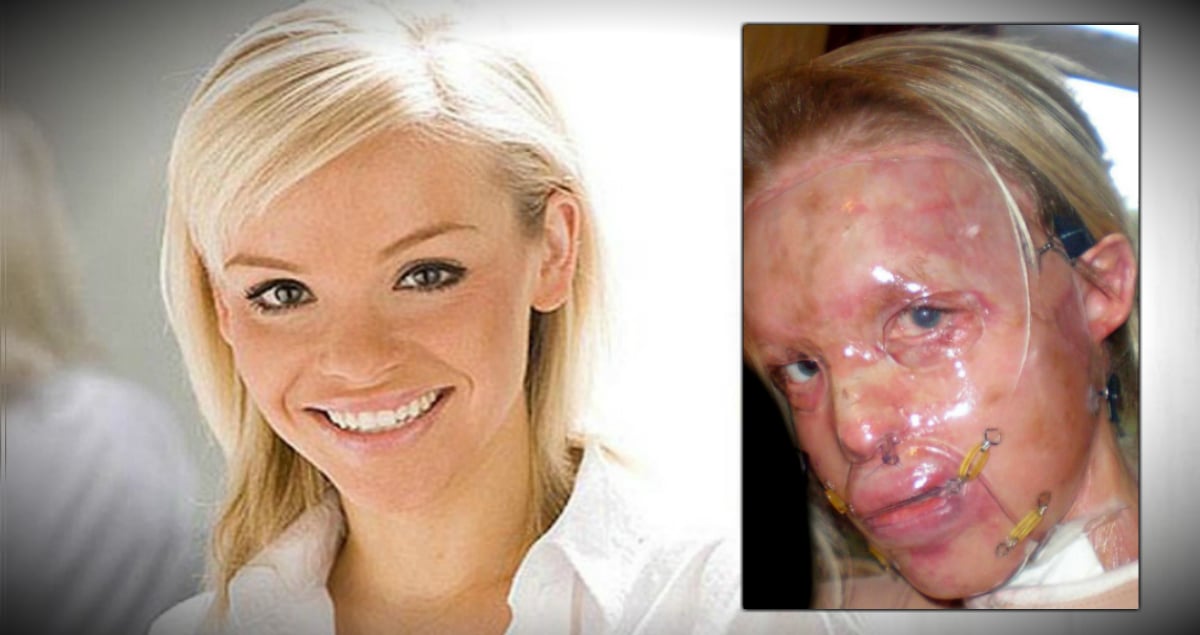 True Inspirational Stories - Katie Piper - Real-Life Hero