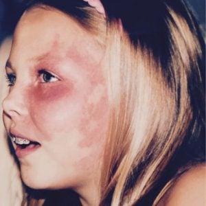 godupdates actress with facial birthmark paige billiot 2