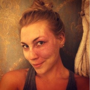 godupdates actress with facial birthmark paige billiot 3