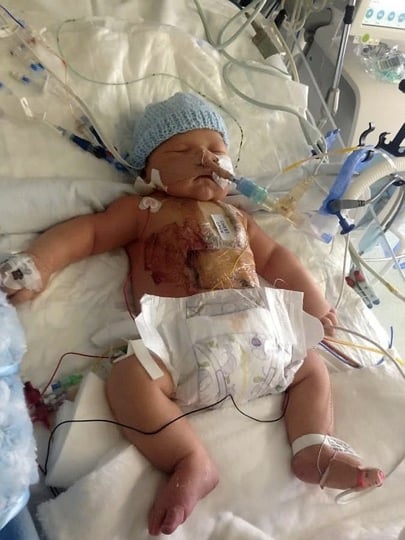 godupdates baby born with half a heart 1