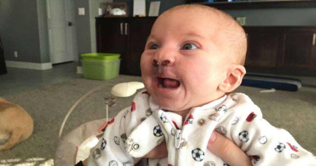 baby born with severe cleft palate act of kindness