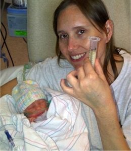 godupdates baby girl born with brain growing out of skull turns 4 3