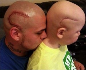 godupdates dad gets tattoo to match son's cancer surgery scar 4