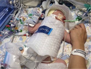 godupdates doctors put baby into a freezer bag to save him 2