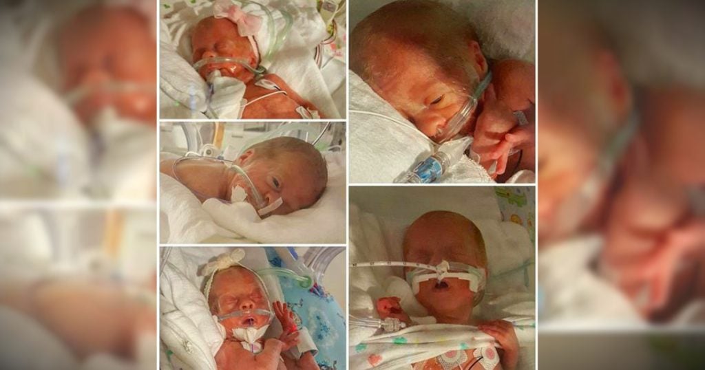 godupdates kentucky couple blessed with miracle quintuplets 2