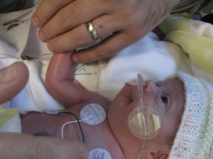 godupdates miracle baby born with no kidneys 4