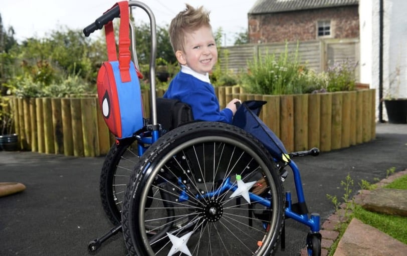 godupdates miracle boy born with virtually no brain recovers 2