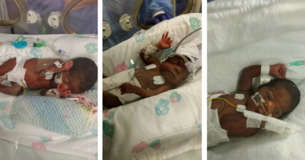 godupdates miracle triplets survived severe illness and are reunited 1