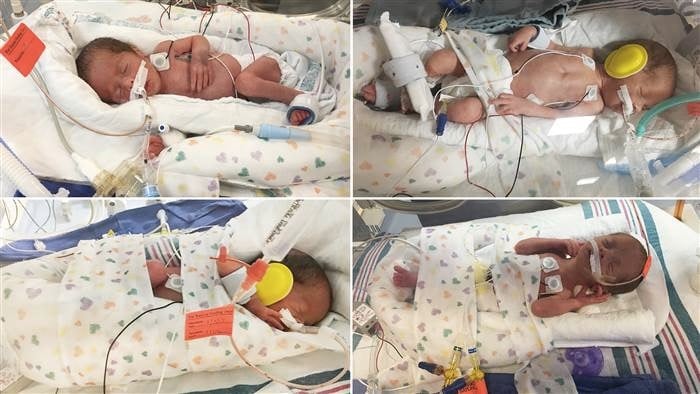 godupdates mom delivered quadruplets while battling cancer 2