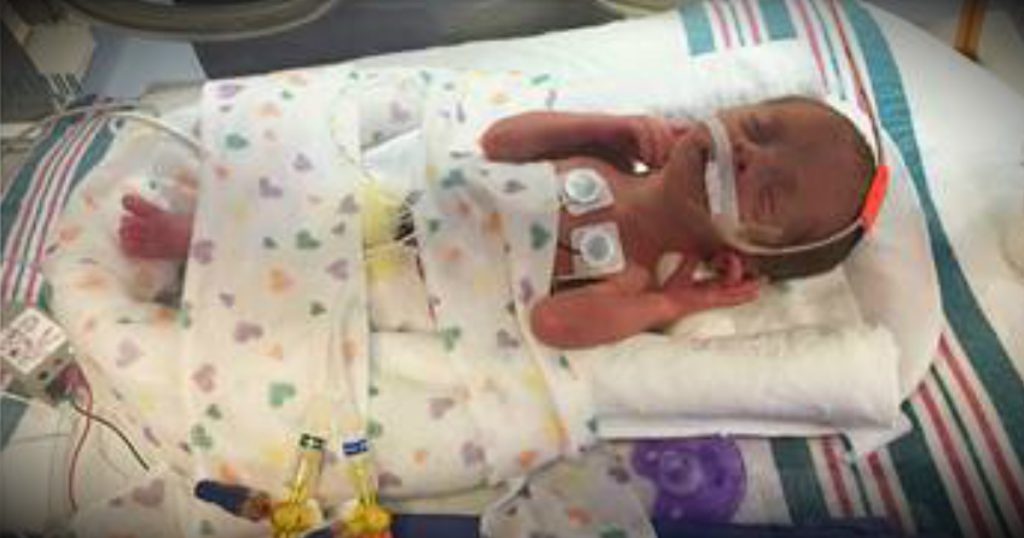 godupdates mom delivered quadruplets while battling cancer fb