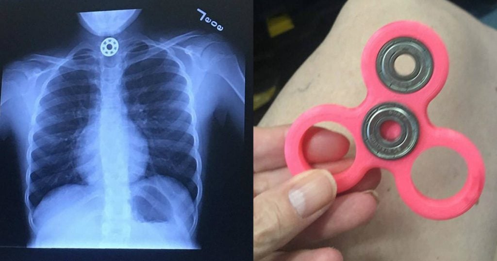 godupdates mom warns after daughter chokes on fidget spinner fb