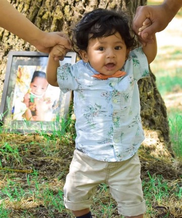 godupdates plastic bag saves baby born with intestines on the outside of body 2