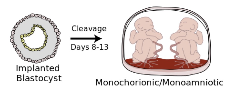 godupdates rare mom twins miracle umbilical cord started choking other 1