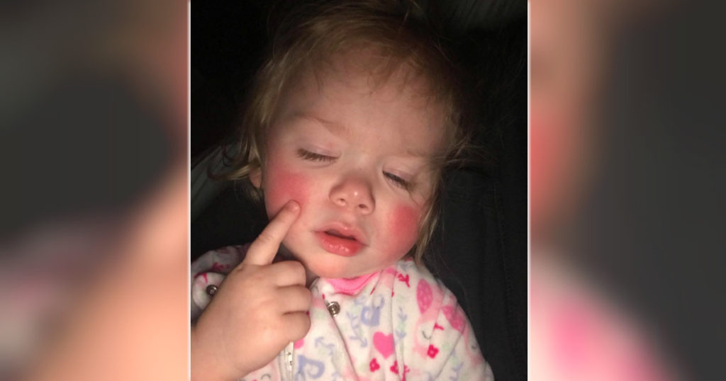 godupdates toddler allergic to water 2