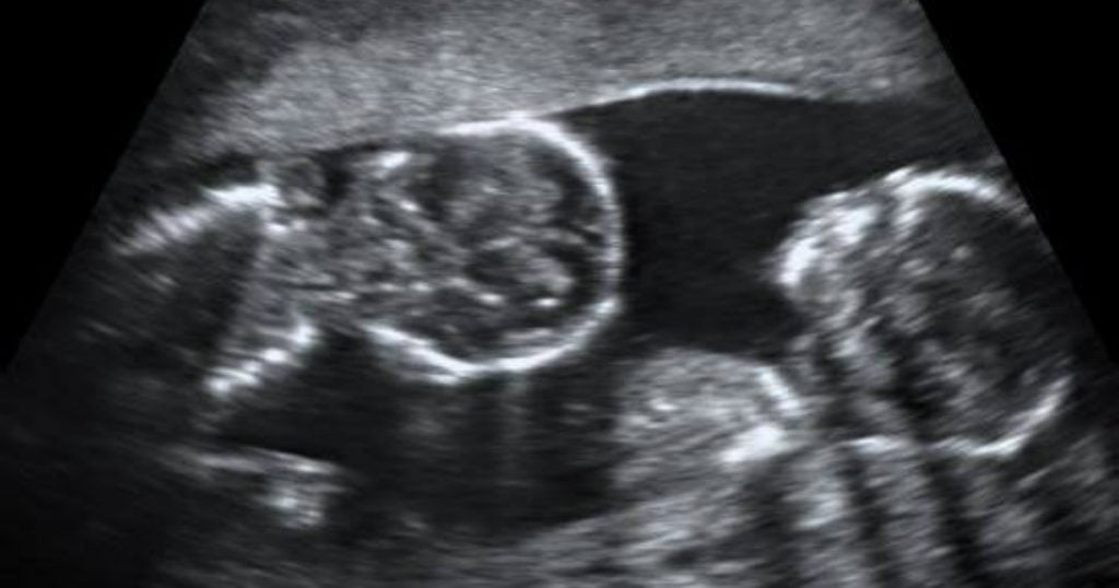 godupdates two babies talk in the womb life after delivery - faith parable fb