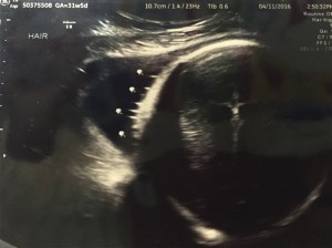 godupdates ultrasound photo of jesus on the cross 1