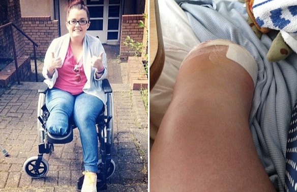 godupdates woman ignored the bump on her foot for 12 years 1