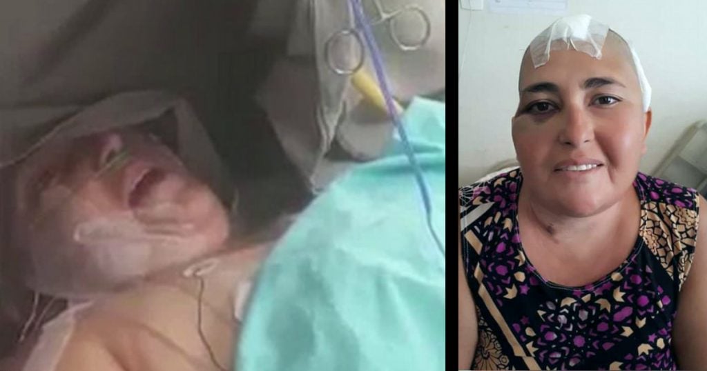 godupdates woman kept awake during brain surgery praises god fb