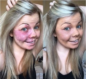 godupdates woman posts No Make-Up Selfie Featuring Her Birthmark 2