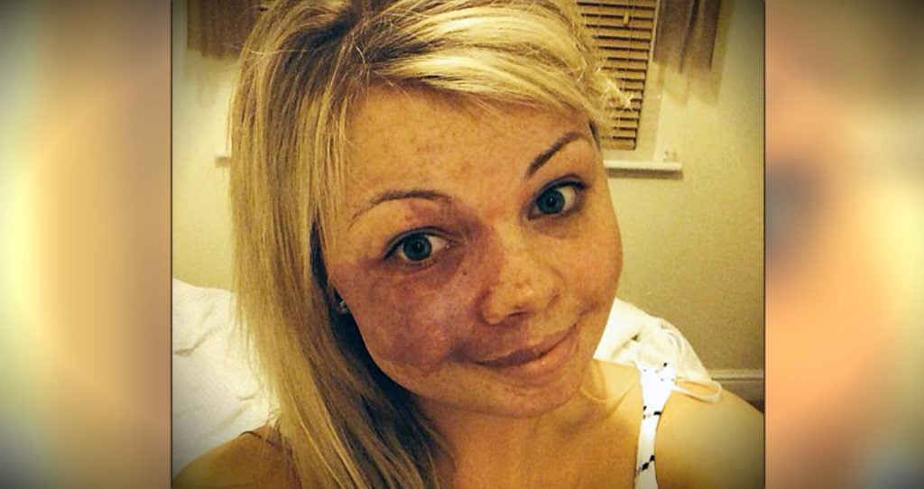 godupdates woman posts No Make-Up Selfie Featuring Her Birthmark fb