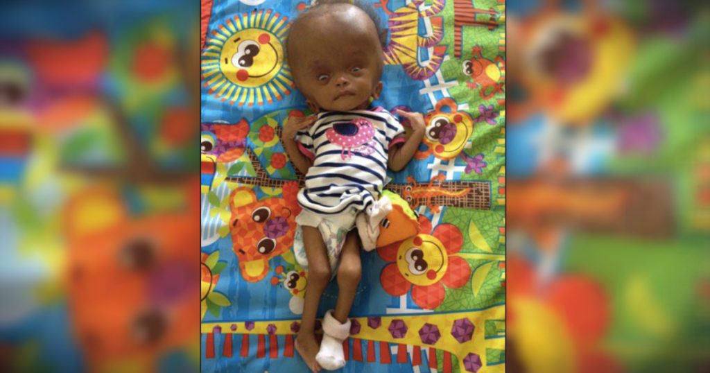 godupdates young woman adopts unwanted baby from haiti doctors said would die 3