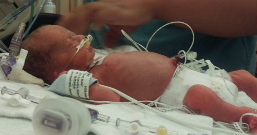 godupdates premature baby finally held