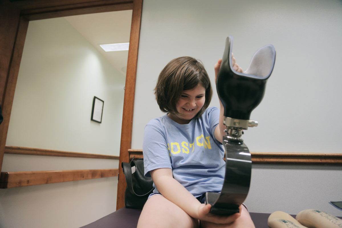 Jane receives her prosthetic leg.  