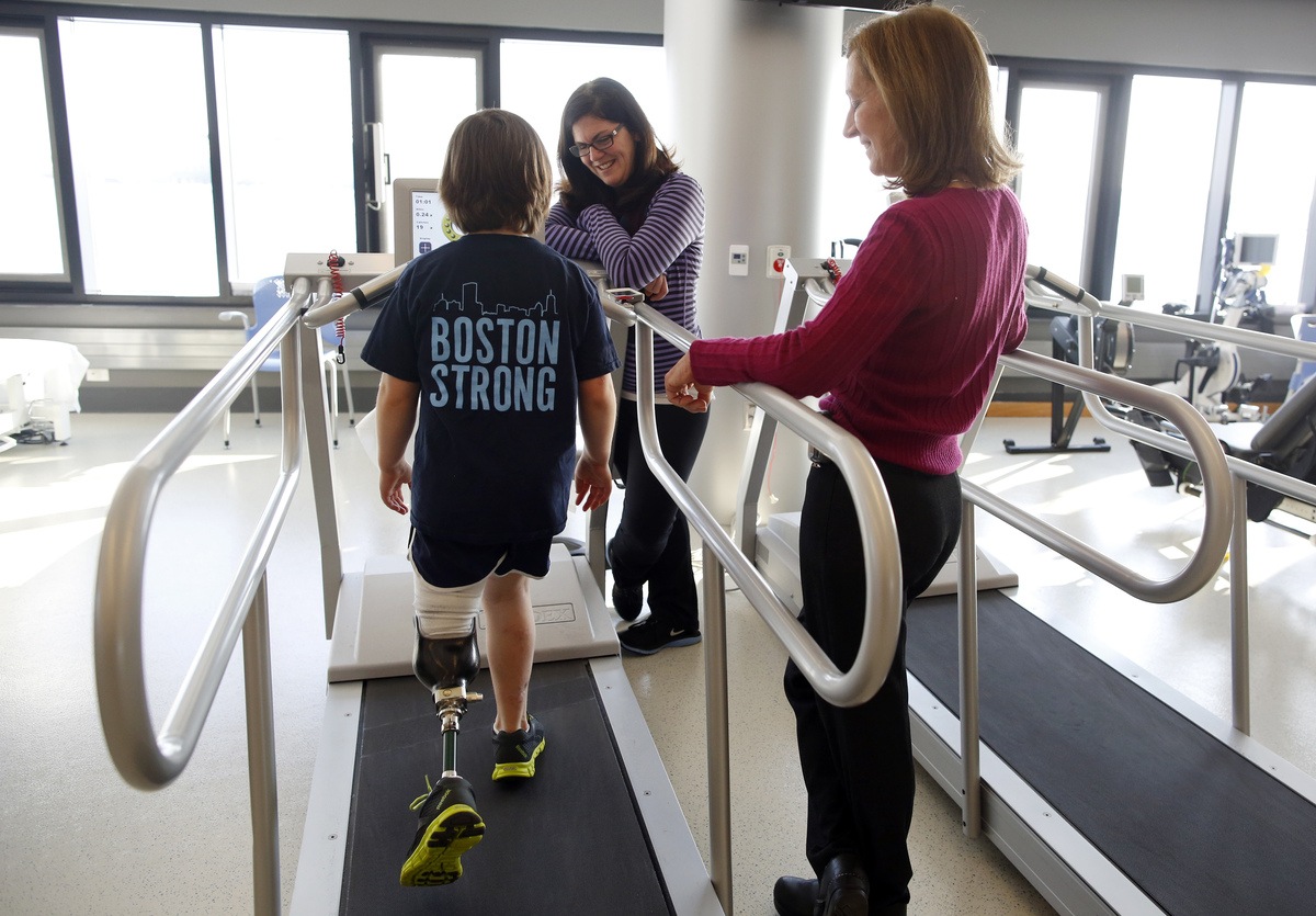 Jane is learning to walk with her prosthetic leg. 