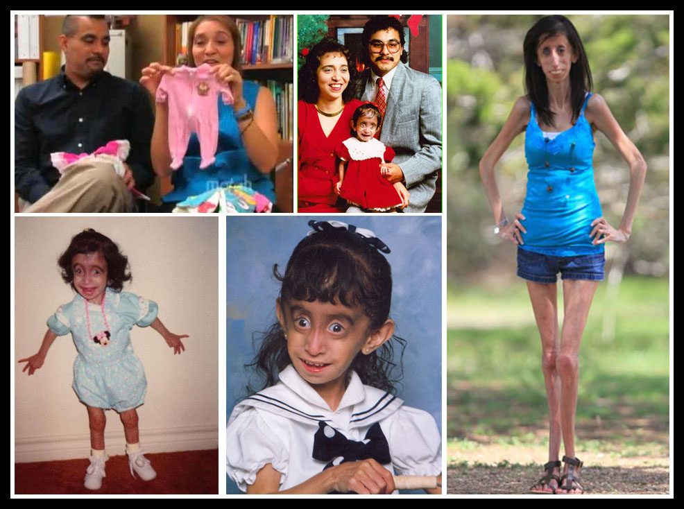 lizzie velasquez family