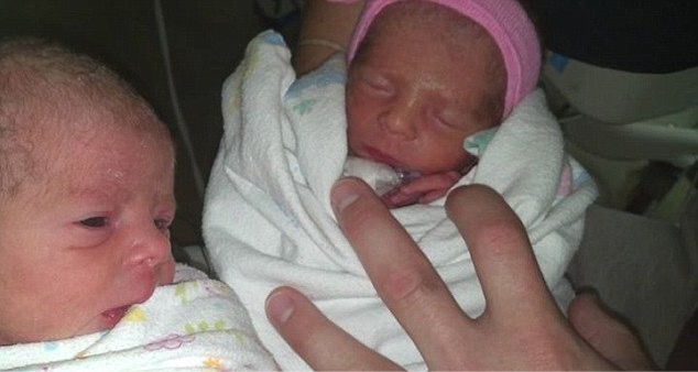 Mom Who Didn T Know She Was Pregnant Delivers Rare Set Of Twins