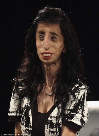 She Was Called The ‘Ugliest Woman Alive.’ And Now She's THANKING The