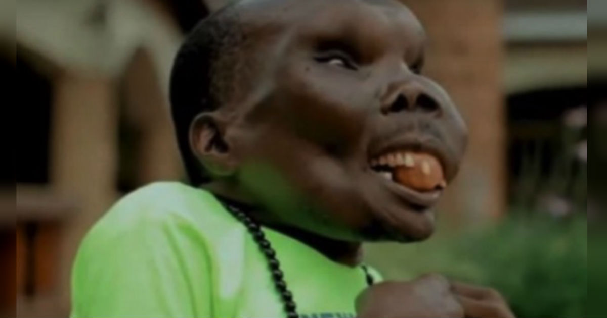 They Call Him The Ugliest Man Alive. But 8 Children Later, He Proves