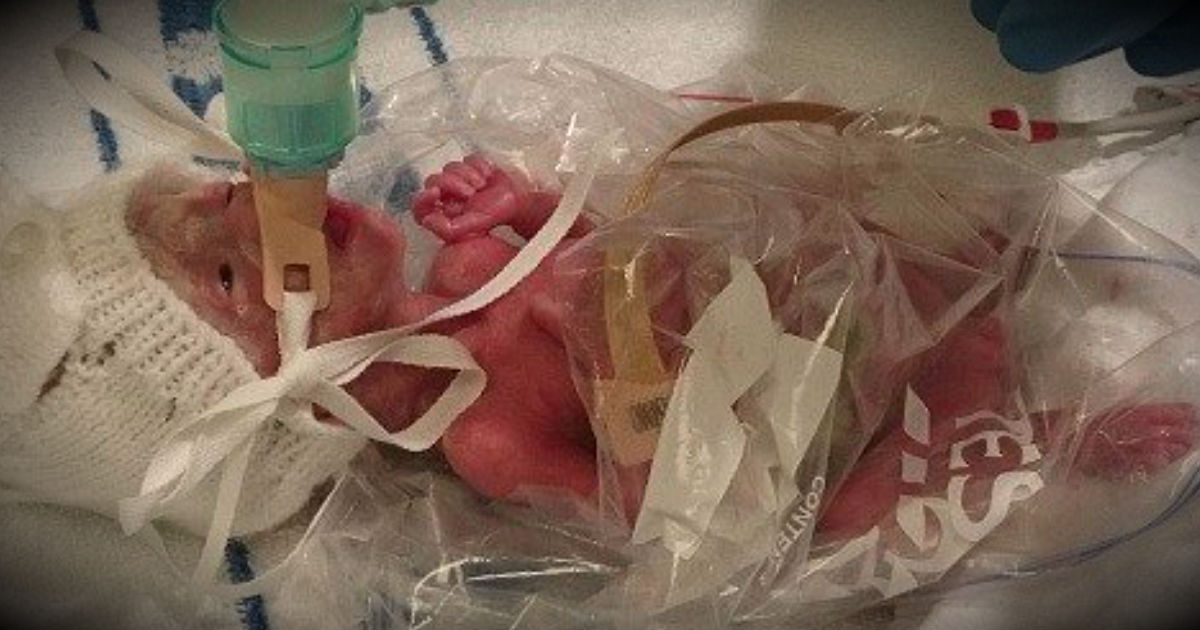 babies chewing on plastic bags